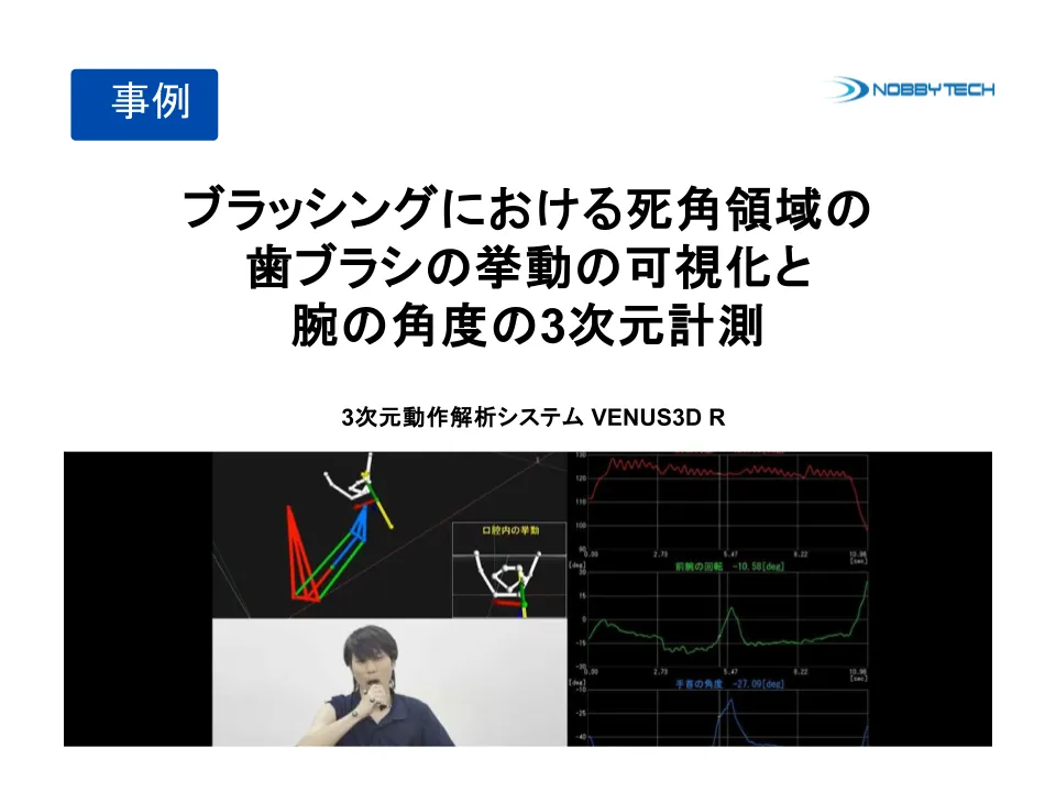 ブラッシングにおける死角領域の歯ブラシの挙動の可視化と腕の角度の3次元計測